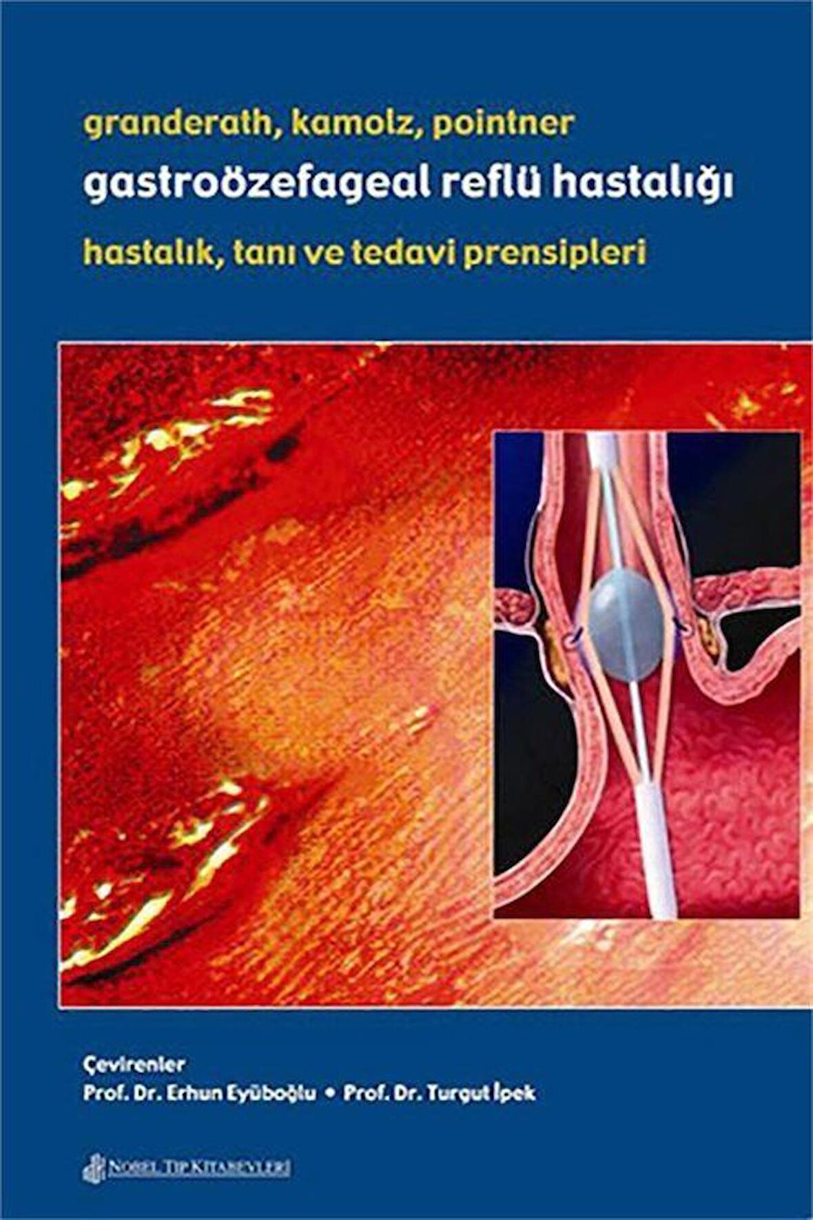 Gastroözefageal Reflü Hastalığı: Hastalık Tanı ve Tedavi Prensipleri / Prof. Dr. Erhun Eyüboğlu