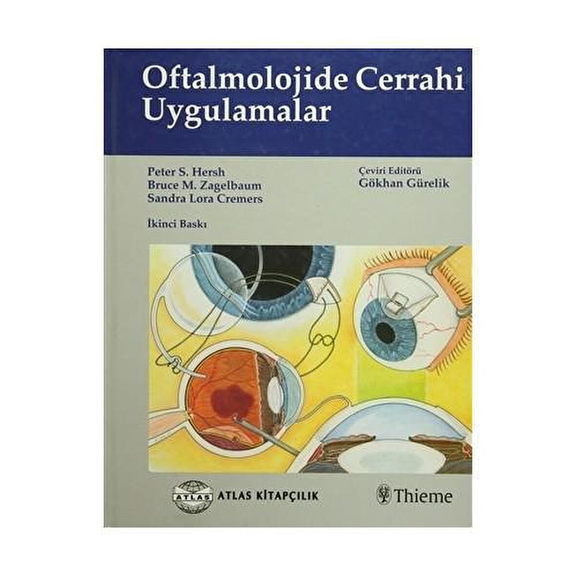 Oftalmolojide Cerrahi Uygulamalar