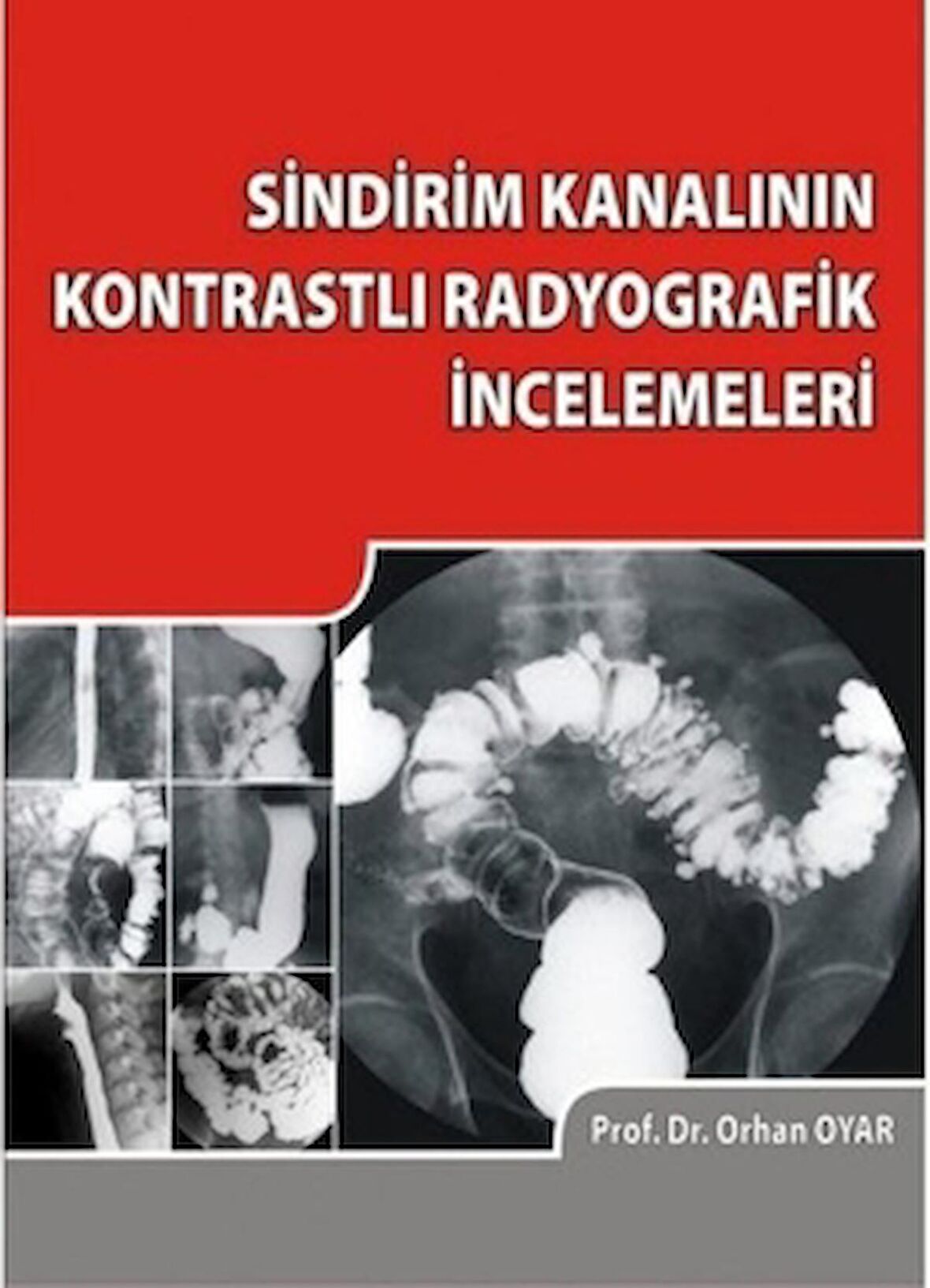 Sindirim Kanalının Kontrastlı Radyografik İncelemeleri