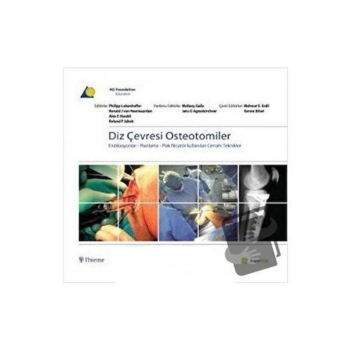 Diz Çevresi Osteotomiler