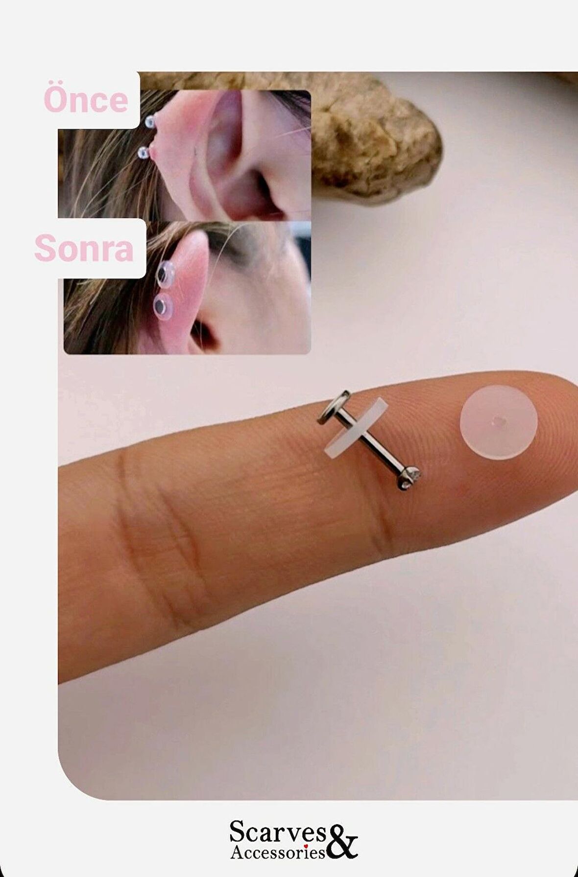 Antialerjik Bioplast Kulak Deliği Şişliği Önleyici Küpe Arkalığı Keloid İyileştirici Silikon Disk 2 Adet