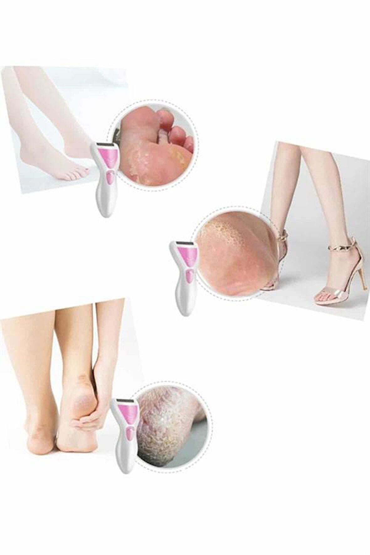 Epilatör Cihazı Epilasyon Aleti Çoklu Başlık Seçeneği Ayak Törpüsü