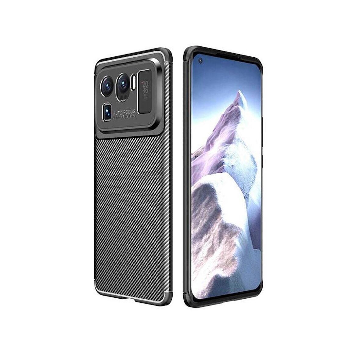 Forzacase Xiaomi Mi 11 Ultra uyumlu Onix Serisi Carbon Fieber Silikon Kılıf