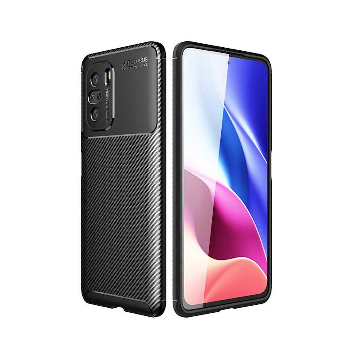 Forzacase Xiaomi Mi 11i uyumlu Onix Serisi Carbon Fieber Silikon Kılıf