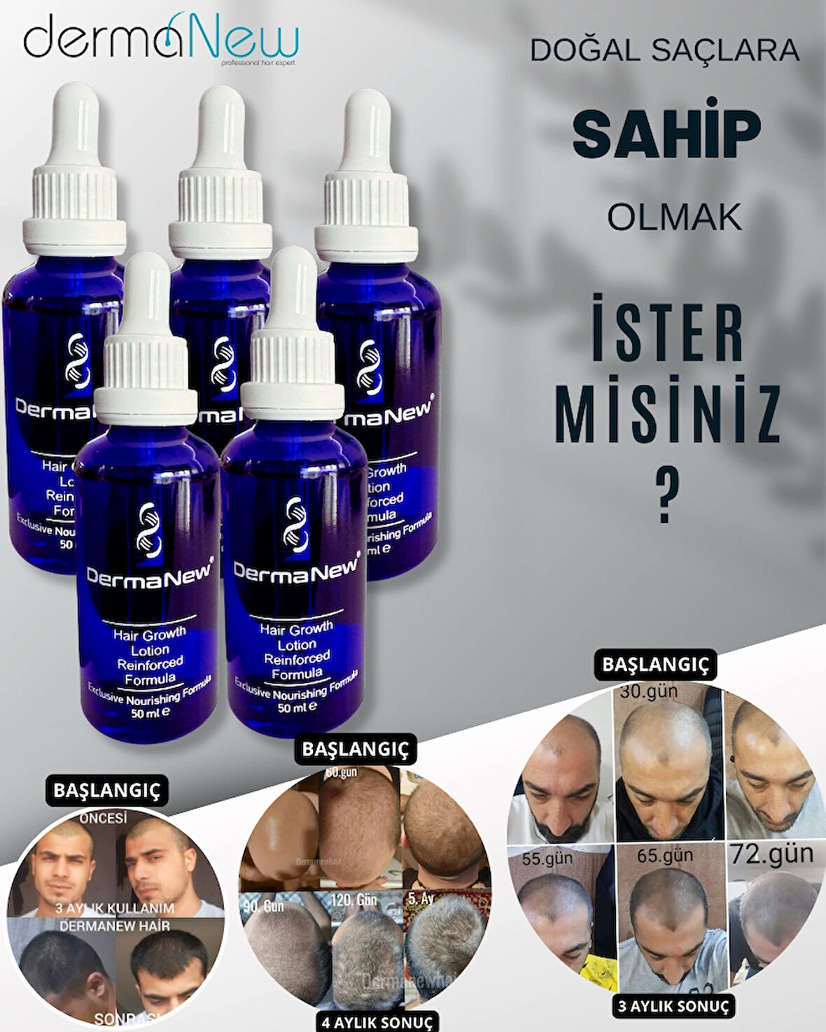 Saç Losyonu Saç Bakım Yağı - saç gürleştirici - saç yağı lotion / 5 Adet Serum