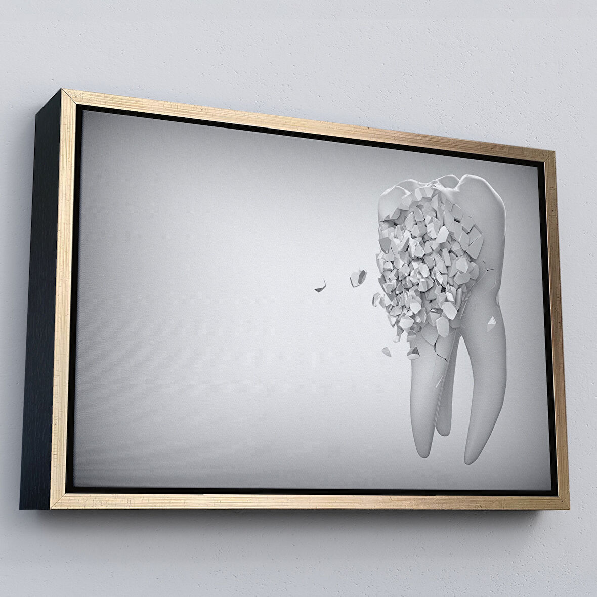 Altın Çerçeveli Diş Kliniği Duvar Tablosu, Çürüyen Diş, Diş Hekimi Tablo