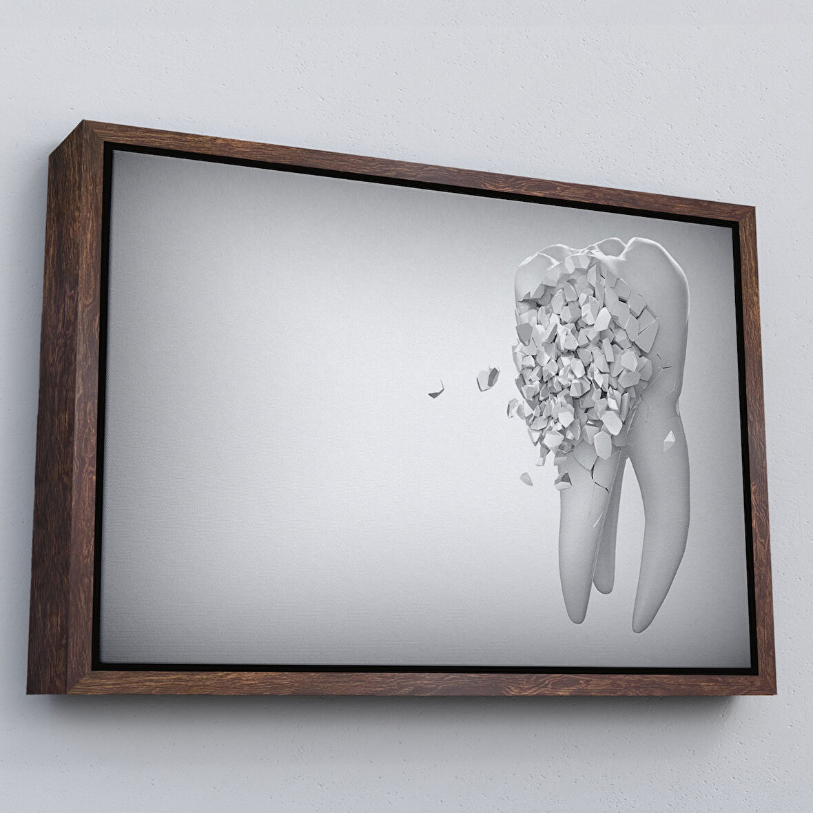 Kahverengi Çerçeveli Diş Kliniği Duvar Tablosu, Çürüyen Diş, Diş Hekimi Tablo