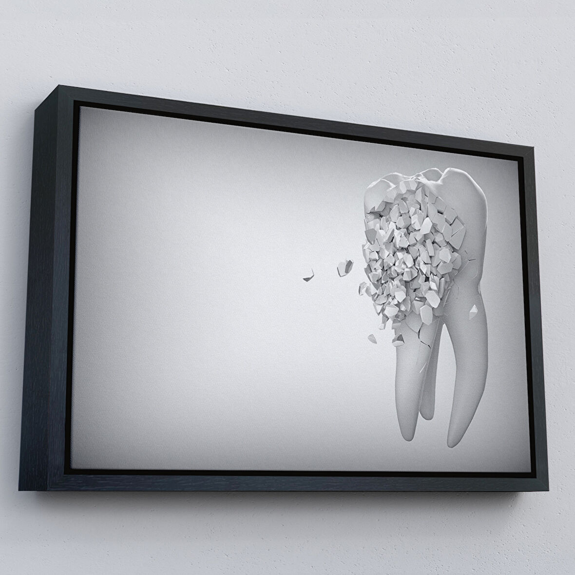 Siyah Çerçeveli Diş Kliniği Duvar Tablosu, Çürüyen Diş, Diş Hekimi Tablo