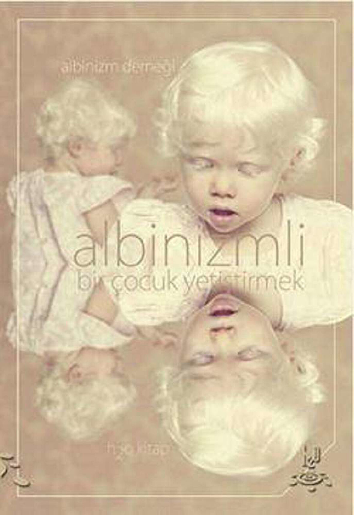Albinizmli Bir Çocuk Yetiştirmek