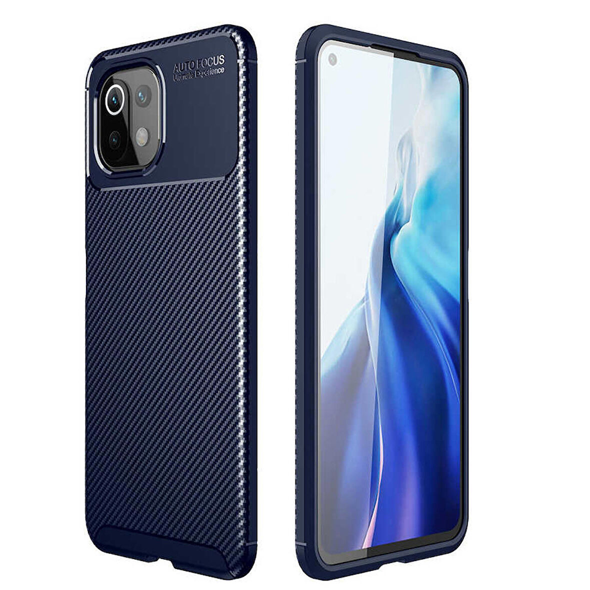 Xiaomi Mi 11 Lite Uyumlu Kılıf Ultra Slim Fit Karbon Silikon