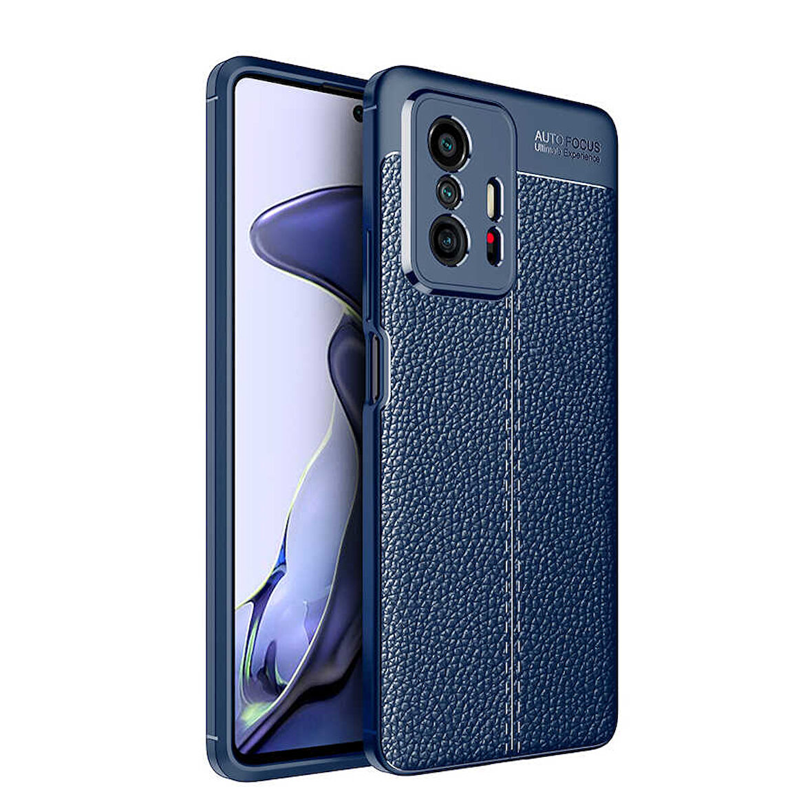 Xiaomi Mi 11T 5G Kılıf Deri Görünümlü Slim Silikon 