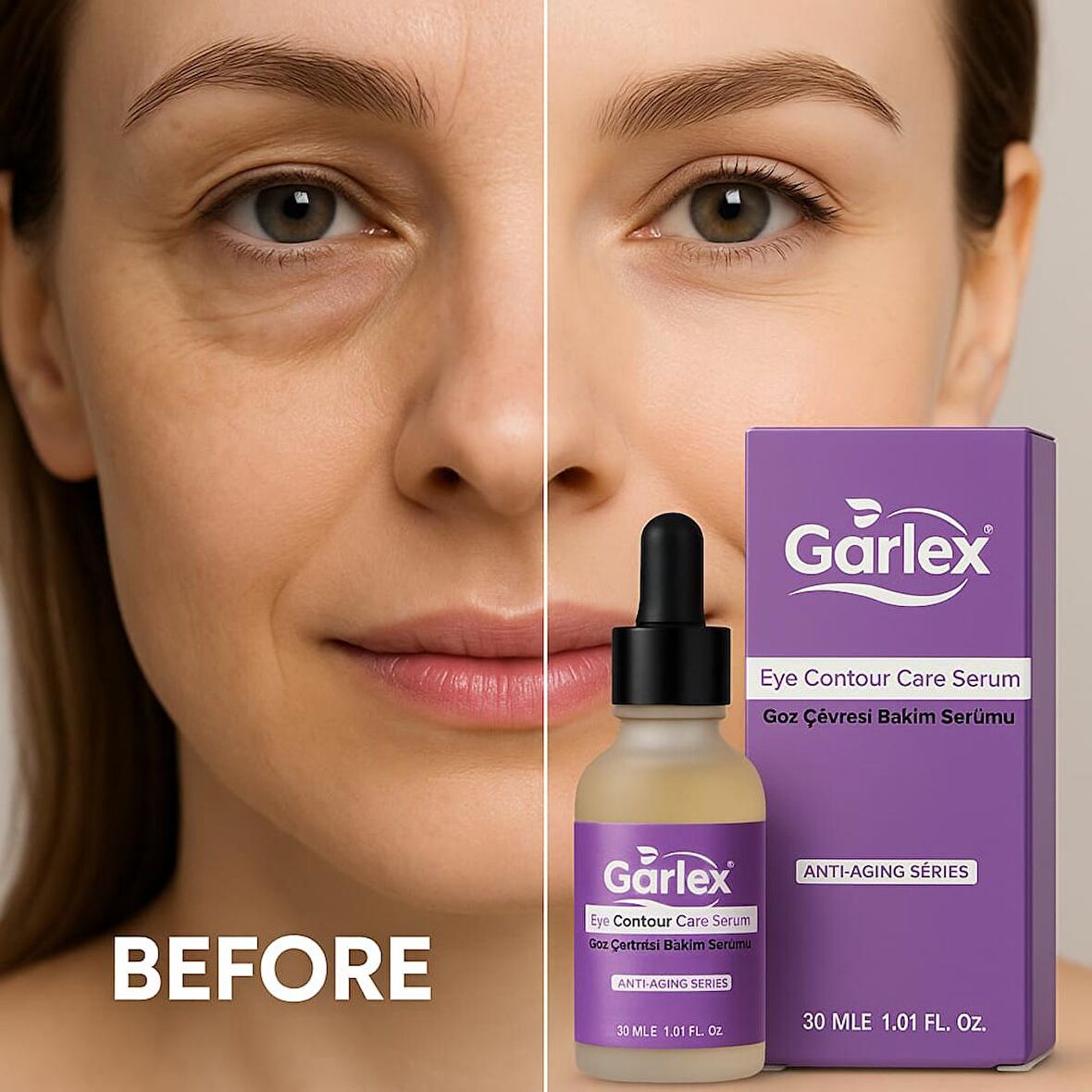 Garlex Göz Çevresi Bakım Serumu 30ml – Kırışıklık Karşıtı, Morluk Giderici, Kolajen Destekli Anti-Aging Serum
