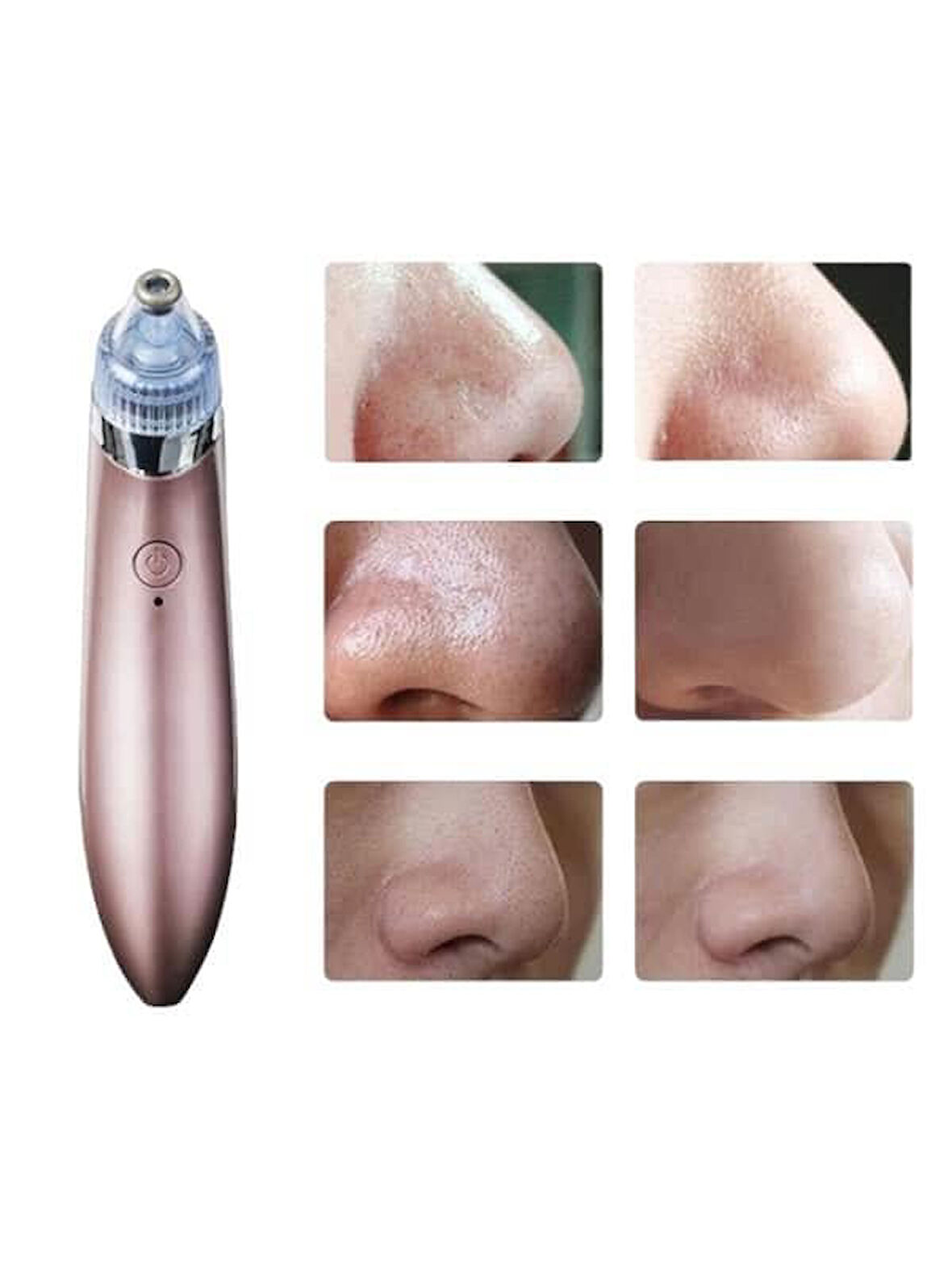 Si̇yah Nokta Ci̇hazi