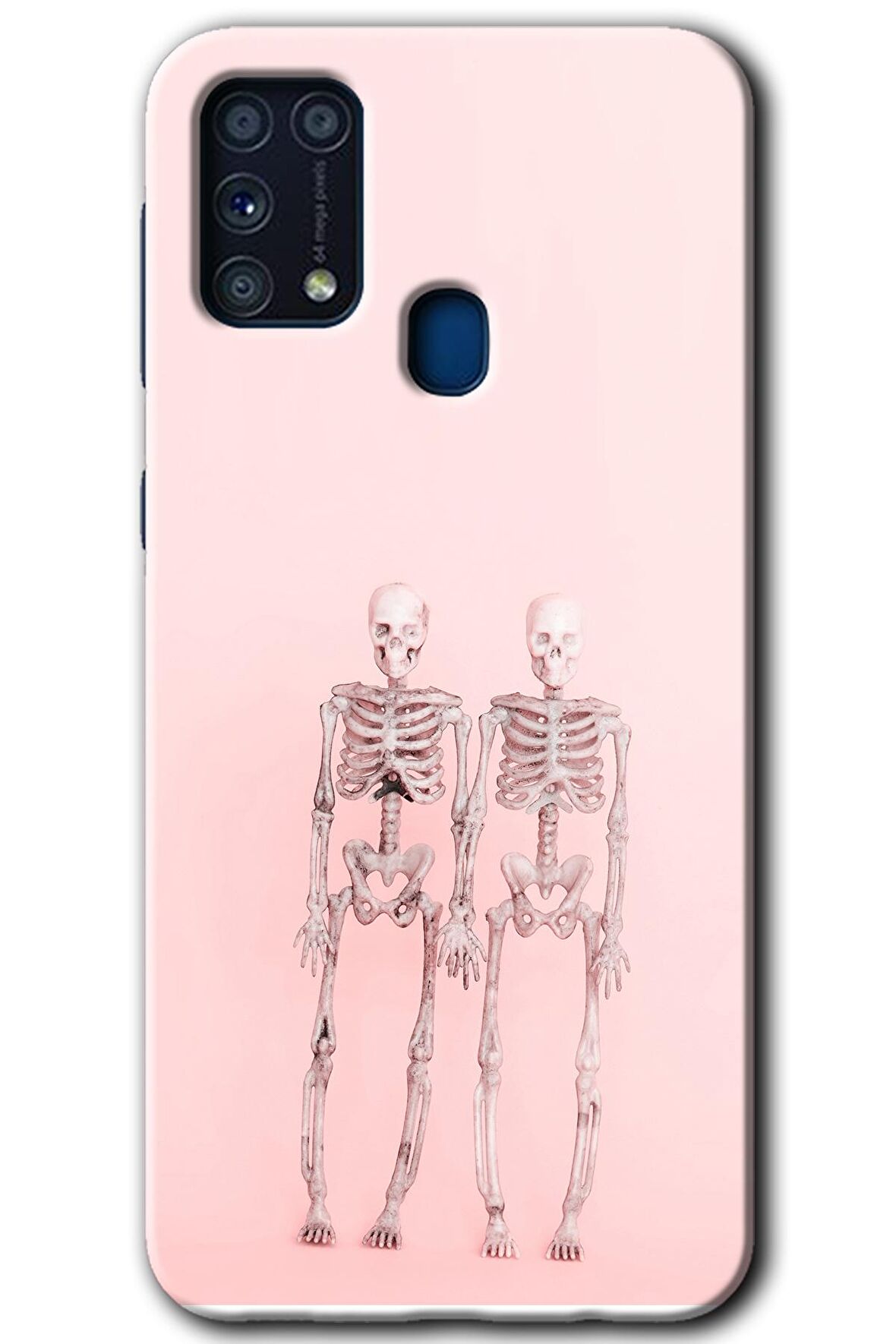 Galaxy M31 Kılıf HD Desen Baskılı Arka Kapak - Yaşayan Çift 