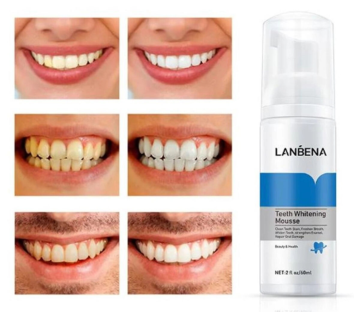 Lanbena Borlu Diş Taşı Temizleme Serumu LANBENA Diş Beyazlatma Formülü İnanılmaz  Sonuç
