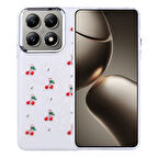 Xiaomi 14T Uyumlu Şık Mini Figürlü Ucay Premium Sert Silikon Kapak