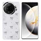 Tecno Camon 30 Pro 5G Uyumlu Kılıf Darbe Koruma Airbag Tasarımlı Simli Şeffaf Kutup Kapak