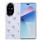 Honor 200 Uyumlu Kılıf Airbag Tasarımlı Simli Şeffaf Kutup Kapak