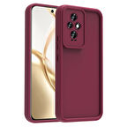 Honor 200 Uyumlu Kılıf Kamera Korumalı Dayanıklı Ananas Kapak