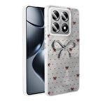 14T Pro Kılıf Kamera Korumalı Figürlü Zore Ponti Silikon Kapak - Açık Mavi