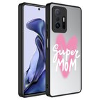Xiaomi Mi 11T Pro 5G Kılıf Aynalı Desenli Kamera Korumalı Parlak Mirror Kapak