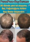 purexpose saç çıaran saç serumu 3adet 1 dermaroller hediyeli