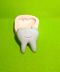Minik Diş  Silikon Kalıp