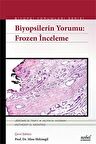 Biyopsilerin Yorumu: Frozen İnceleme