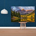 Tuval Üzerine Dijital Baskı Modern Sanatsal Kanvas Tablo 35x50 Tablo-