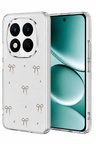 Redmi Note 15 Pro 4G Fiyonk Desenli Kapak - Desen 5