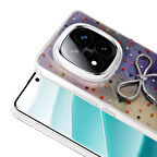 Xiaomi Poco X7 Kılıf Figürlü Kamera Korumalı Silikon Zr-Ponti