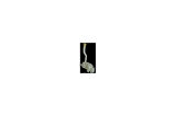 2002-2005 Jeep Cherokee Lıberty Ön Cam Su Bidonu-Deposu (Motorsuz) (Tw) (Adet) (Oem No:5066867Aa)