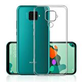 Smcase Huawei Mate 30 Lite Kılıf Lüks Korumalı Silikon  Tam Kapatan Nano Ekran Koruyucu