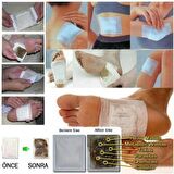 Mobgift DETOX AYAK BANDI (10 ADET)