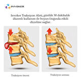 Boyun Ağrısı ve Fıtığı Boyun Düzleşmesi Oturma Bozukluğu Disk Sıkışması Servikal Traksiyon Aleti