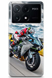 Xiaomi Poco X6 Pro uyumlu Otomoto 36 HD Koruma Süper Hızlı Motor