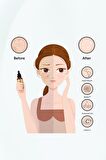 NEW ESSENTIALS LEKE KARSITI SERUM 30ML