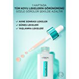 L'Oréal Paris Bright Reveal Sivilce, Güneş, Yaşlanma Lekelerinde Etkili Koyu Leke Karşıtı Serum 10% Niasinamid 30 ml