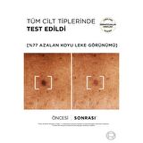 L'Oréal Paris Bright Reveal Sivilce, Güneş, Yaşlanma Lekelerinde Etkili Koyu Leke Karşıtı Serum 10% Niasinamid 30 ml
