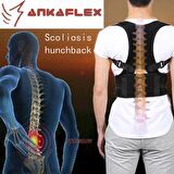 Ankaflex Medikal Kifoz Korsesi Skolyoz Korsesi Dik Duruş Korsesi Ortopedik Dik Durmak İçin Aparat