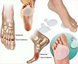 Silikon Metatarsal Ped Ayak Altı Ağrı Nasır Koruma Parmağa Halka