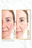 Avon Anew Renewal Power Serum 30 Ml. 