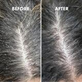 Saç Derisi İçin Bitki Özlü Nemlendiri Serum 50 ML