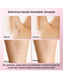 pure es T4 Taşınabilir IPL Lazer Epilasyon Cihazı 