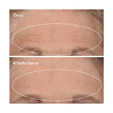 Murad Retinal Resculpt Overnight Treatment (Retinol İçeren Yenileyici Mucize Gece Serumu) 30 ml