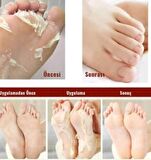 MARLETT AYAK PEELING MASKESİ
