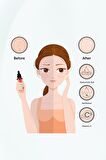 C Vitamini Serum 30 ml