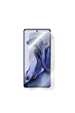 Xiaomi 11t - Mi 11t Görünmez Hydrogel Ekran Koruyucu