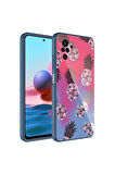 Xiaomi Redmi Note 10S Uyumlu Kılıf Kamera Korumalı Desenli Sert Silikon Zore Epoksi Kapak NO3