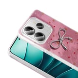 Xiaomi Redmi Note 14 5G Uyumlu Kılıf Kamera Korumalı Figürlü Zore Ponti Silikon Kapak